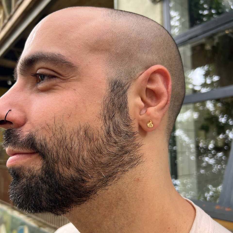 Aretes On Fire